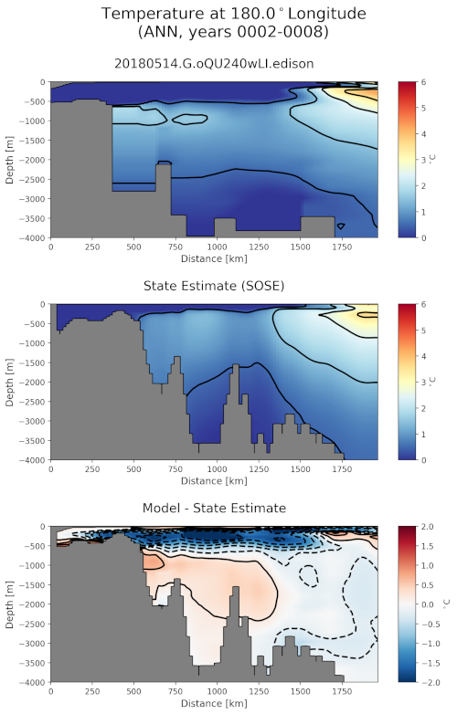 ../_images/sose_transect.png