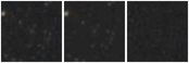 Missing file PGC038899-custom-montage-W1W2.png