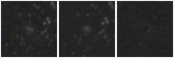 Missing file PGC039866-custom-montage-W1W2.png