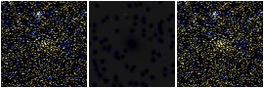 Missing file 2MASXJ12362919+1818022-custom-montage-FUVNUV.png