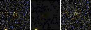 Missing file SDSSJ125651.47+163024.2-custom-montage-FUVNUV.png