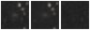 Missing file PGC038844-custom-montage-W1W2.png