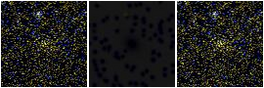 Missing file 2MASXJ12362919+1818022-custom-montage-FUVNUV.png